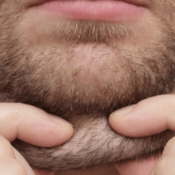 man with double chin
